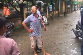 Kẻ gây án Nguyễn Văn Đông bị lực lượng chức năng bắt giữ.