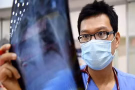BS. Hùng Ngô trong ca trực tại bệnh viện Bạch Mai (Hà Nội).