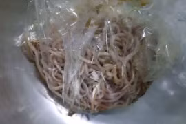 Búi giun to lấy ra khỏi cơ thể của V.