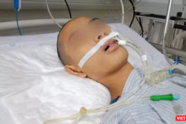 Bệnh nhi hôn mê, thở máy, điều trị đã nhiều ngày tại Khoa Truyền nhiễm, Bệnh viện Nhi Trung ương vì mắc bệnh viêm não Nhật Bản