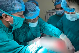 Các bác sĩ phẫu thuật loại bỏ khối u to cho bà V.