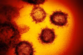 Hình ảnh qua kính hiển vi điện tử cho thấy virus corona chủng mới xuất hiện trên bề mặt tế bào người (Ảnh: Live Science)