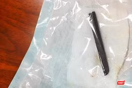Chiếc đũa 9cm được lấy ra từ hốc mũi