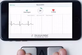 Ảnh: INTERMOUNTAIN MEDICAL CENTRE HEART INSTITUTE / DPA 