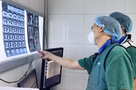 TS.BS Lê Thanh Dũng – Trưởng Trưởng khoa Chẩn đoán hình ảnh, Bệnh viện Hữu nghị Việt Đức đang hội chẩn can thiệp cấp cứu cho BN Đ. (Ảnh - BVCC)