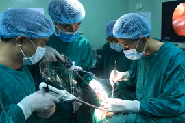 Các bác sĩ sử dụng khâu máy tự động để phẫu thuật lồng ngực cho bệnh nhân (Ảnh - BVCC) 
