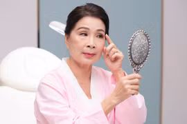 Nghệ sĩ Kim Xuân lo lắng vì ngoại hình lộ rõ dấu hiệu tuổi tác