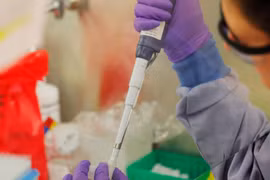 Xét nghiệm nhanh người nhiễm virus Corona giúp ích rất nhiều cho việc cách ly và điều trị (ảnh: Nikkei) 