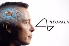 Neuralink cấy ghép chip não thành công cho bệnh nhân đầu tiên