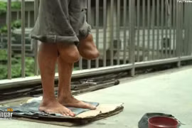 Người ăn xin cụt chân lộ nguyên hình