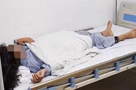 Bé gái 13 tuổi đang được điều trị tại Bệnh viện Da liễu Trung ương. 