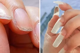 Ảnh mình họa