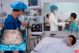 Bệnh nhân cấp cứu vì lạm dụng thực phẩm chức năng. Ảnh: MT