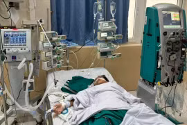 Lần đầu lọc máu liên tục cho bệnh nhi, cứu sống cháu bé 10 tuổi
