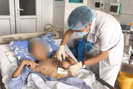 Người quản trang suýt chết vì một loại nấm đen hiếm gặp
