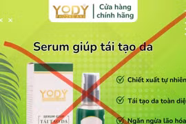 32 lô mỹ phẩm của Công ty dịch vụ thẩm mỹ Yody Phương Anh bị thu hồi