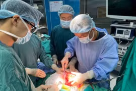 Bác sĩ Bệnh viện Bạch Mai cứu sống cô gái có khối u thận “khủng”