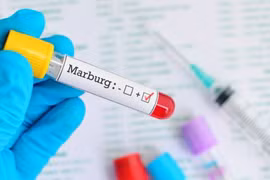 Virus Marburg khiến 9 người chết và WHO lập tức phải họp khẩn (ảnh: Bimbisaniebelli)