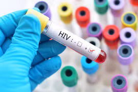 Nghiên cứu mới làm dấy lên hy vọng về một liệu pháp loại bỏ hoàn toàn virus HIV khỏi cơ thể người (Ảnh: Getty)