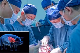 Nhóm khoa học Đại học Y khoa An Huy đã thực hiện thành công ca ghép gan lợn đã chỉnh sửa gene cho bệnh nhân ung thư (Ảnh: Guangming)