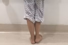 Sau lần phẫu thuật cách đây 4 năm, nữ sinh Đỗ Thị Kim C. phải chịu đôi chân lệch nhau 2 cm, dáng đi tập tễnh khiến em tự ti.