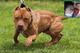 Một con chó Pitbull tấn công em bé 4 tuổi và mẹ, khiến các nạn nhân bị thương nặng, cấp cứu tới Bệnh viện Đa khoa Trung ương Thái Nguyên (Ảnh: BVCC + Internet)