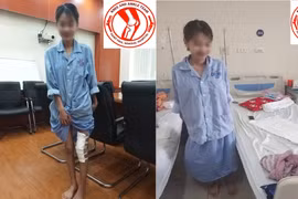 Nữ sinh U. đứng, tập đi lại sau khi được phẫu thuật.