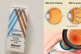 Tự ý sử dụng thuốc Tobradex, đôi mắt có thể bị tổn thương nặng, thậm chí mù lòa.
