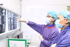 Bác sĩ xem kết quả chụp CT của người đàn ông trước khi thực hiện can thiệp nội mạch.