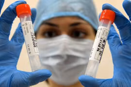 Có hay không “doanh thu khủng” từ việc bán vaccine COVID-19 “đốt cháy giai đoạn” của Nga? (Ảnh: AFP)) 