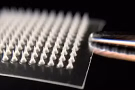 Miếng dán gồm rất nhiều mũi kim siêu nhỏ có thể đánh tan mỡ thừa hiệu quả. Ảnh: Sciencealert