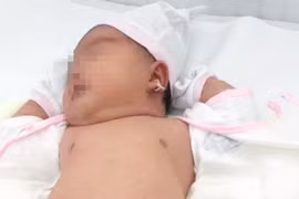 Bé gái chào đời nặng 5.2kg tại Bệnh viện Quận 11
