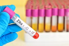 TP HCM ghi nhận 3 trường hợp nhiễm virus Zika.