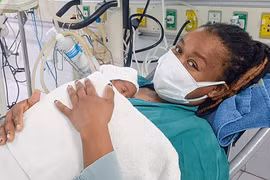 Chị Lydia Nanja N và bé L.W.D được áp dụng phương pháp ấp con kangaroo. (ảnh BVCC)