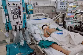 Bệnh nhi được điều trị kèm chỉ định lọc máu liên tục