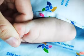 Trẻ từ 15 tuổi trở xuống chiếm phần lớn trong số các tử vong do sốt xuất huyết.