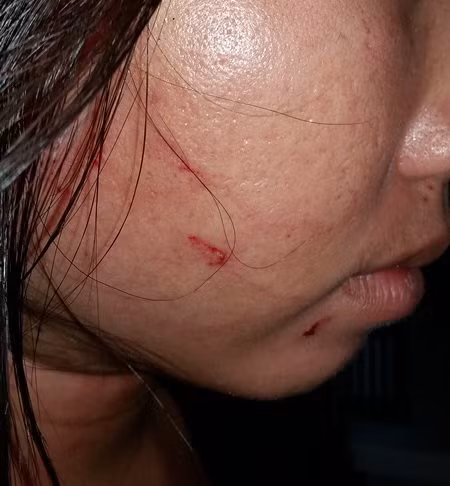 Phản ảnh cân thiếu hải sản, nữ du khách bị đánh rách mặt