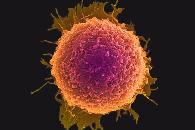 Đĩa nano có thể diệt các tế bào ung thư?