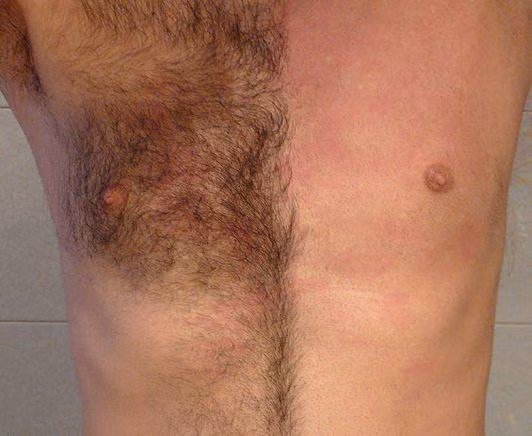 Lông trên cơ thể người (Ảnh: Hack Spirit)