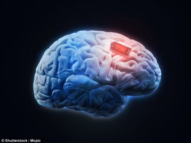 Kinh ngạc với dự án cấy chíp giúp não người có bộ nhớ siêu phàm ảnh 1