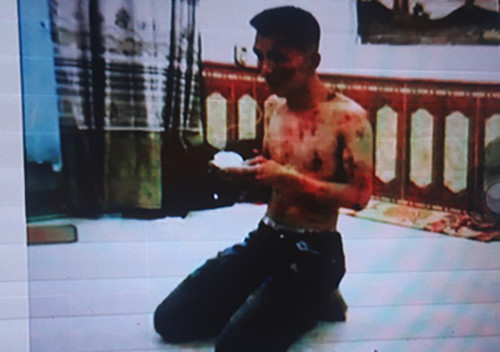 Nhóm tín dụng đen lớn nhất nước bị triệt phá ảnh 2 Một nạn nhân bị tra tấn tại công ty tài chính Nam Long. Ảnh: Công an cung cấp.