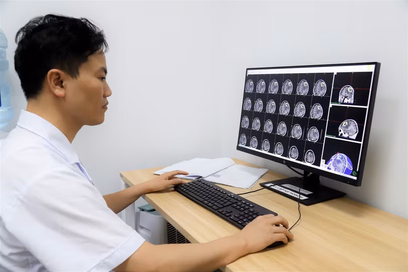 TS.BS. Nguyễn Đức Liên -Trưởng khoa Ngoại thần kinh, Bệnh viện K. 