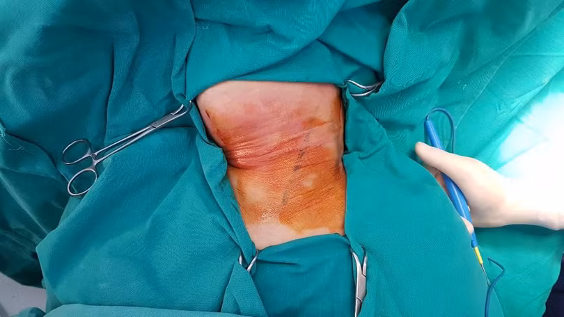 Hình ảnh tổn thương của bệnh nhân. Ảnh: Bệnh viện cung cấp 