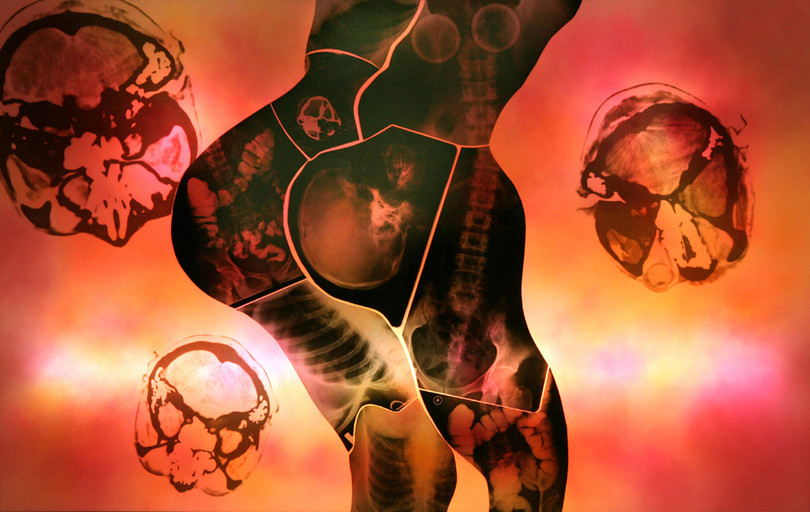 Mỹ nhân - X quang trên hộp đèn - Tác phẩm của họa sĩ Doãn Hoàng Lâm. 