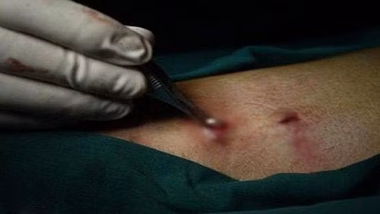 Phẫu thuật ở phòng khám tư tiềm ẩn nhiều rủi ro không thể lường trước (Ảnh minh hoạ)