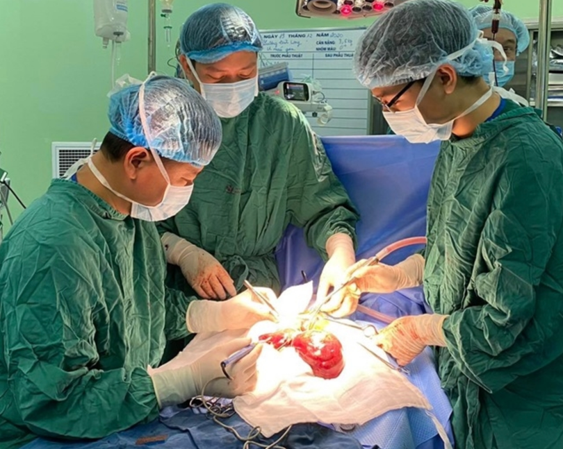 Các bác sĩ phẫu thuật loại bỏ khối u máu khổng lồ cho bệnh nhi (Ảnh: BVCC) 