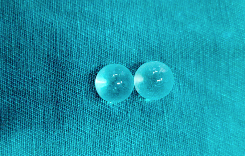 2 viên bi được cấy vào thân dương vật sát quy đầu của người bệnh. Ảnh: BVCC