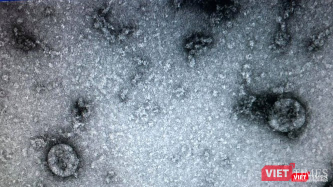 Virus SARS-CoV-2 (Ảnh: Minh Thuý) Virus SARS-CoV-2 (Ảnh: Minh Thuý)