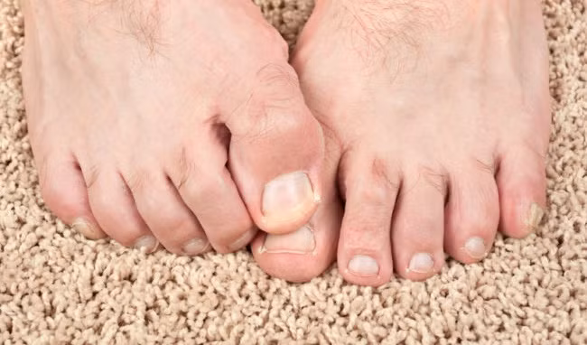 Bàn chân. Ảnh: Internet