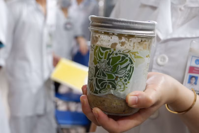 Bộ Công an đang tiến hành điều tra về vụ ngộ độc pate Minh Chay. Ảnh: Lê Minh 